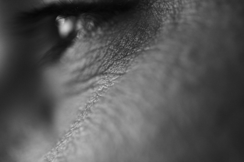 photo macro d'un oeil où le reflet donne l'impression d'une pupille blanche, noir-blanc